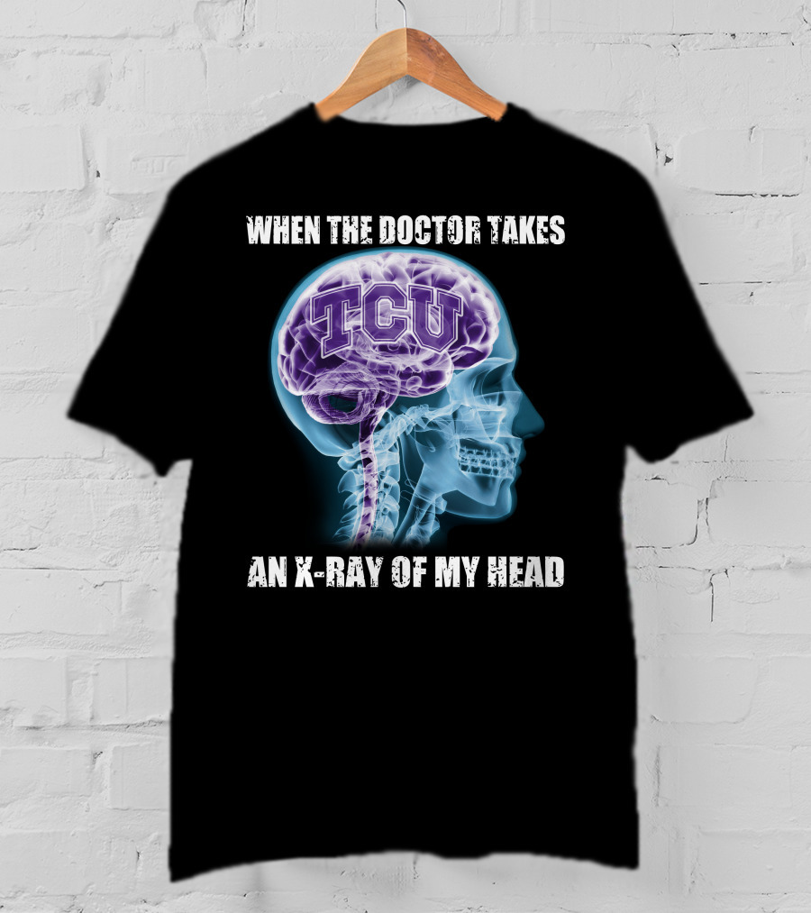TCU Horned Frogs When The Doctor Takes An X-ray Of My Head T-Shirt