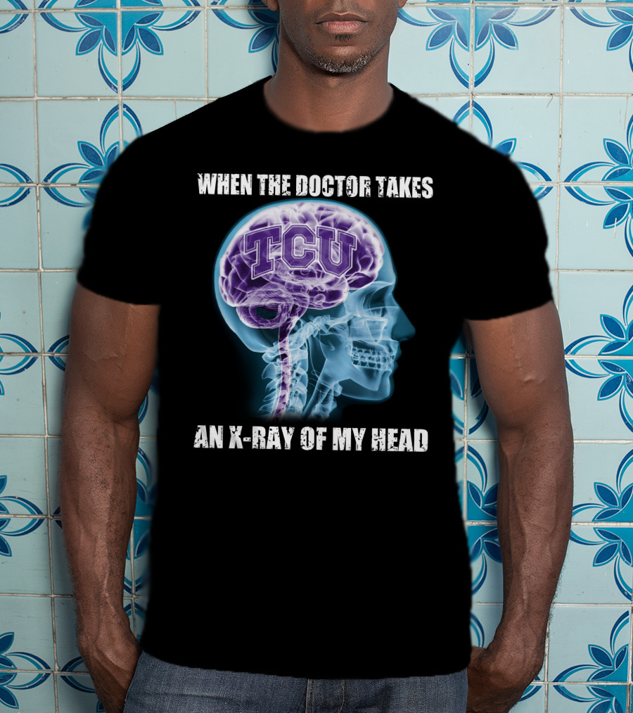 TCU Horned Frogs When The Doctor Takes An X-ray Of My Head T-Shirt