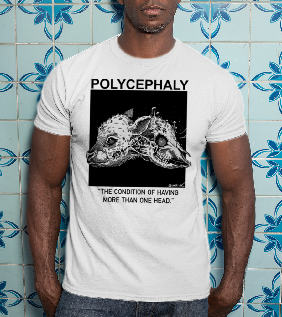 Polycephaly The Condition Of Having More Than One Head T-Shirt