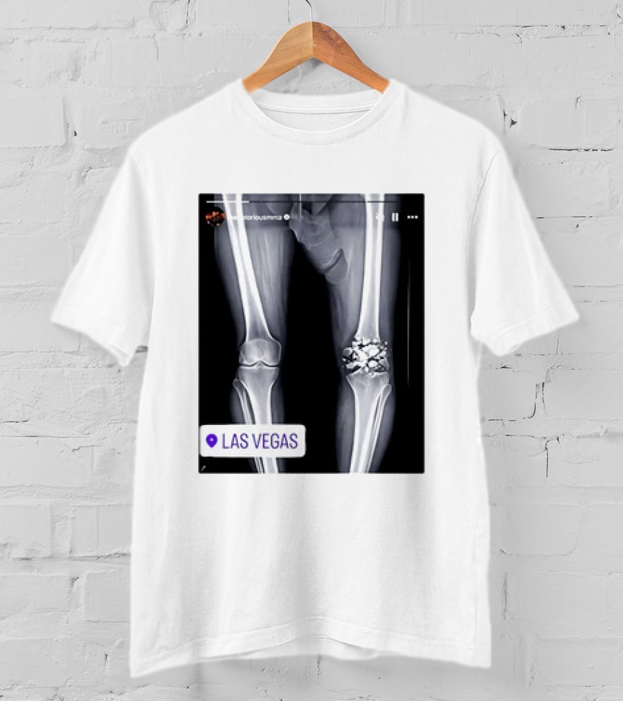 Conor McGregor X Ray Broken Knee Las Vegas T-Shirt