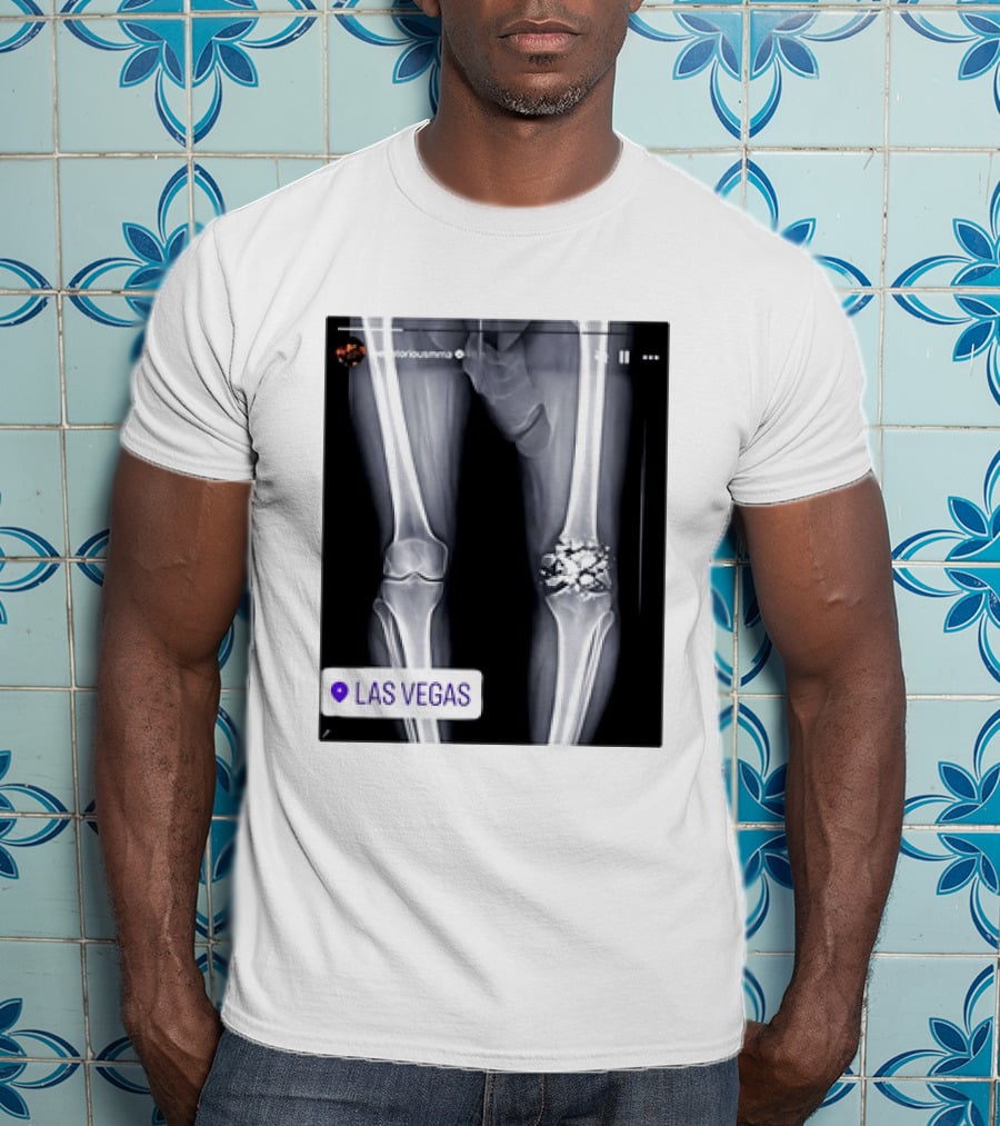 Conor McGregor X Ray Broken Knee Las Vegas T-Shirt